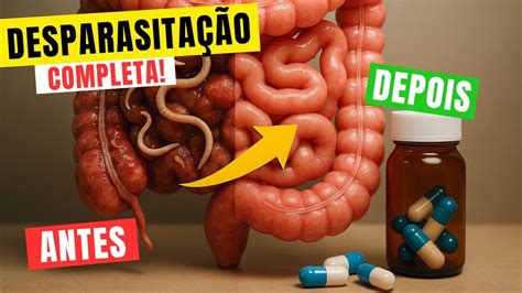 Como Fazer A Desparasitação - A MELHOR FORMA de fazer uma DESPARASITAÇÃO COMPLETA - YouTube