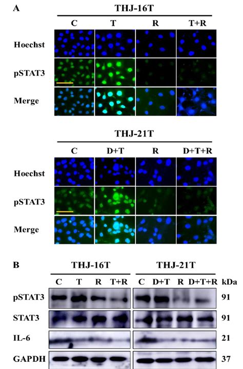 Variable Pstat3 Stat3 And Il 6 Levels In Thj 16t And Thj 21t Cells Download Scientific