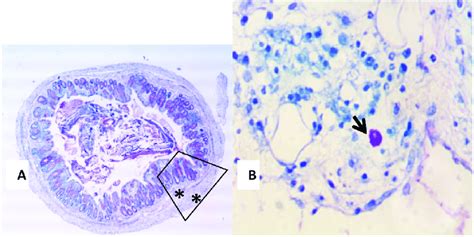 A And B Toluidine Blue Stained Colonic Section A Showing A