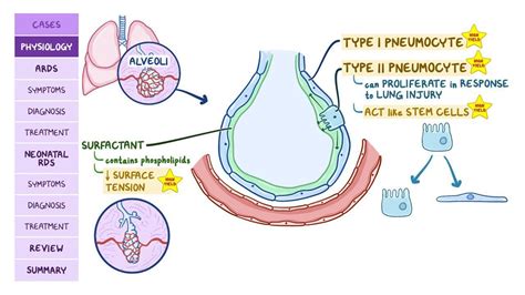 Wet Lung What Is It Causes Treatment And More Osmosis