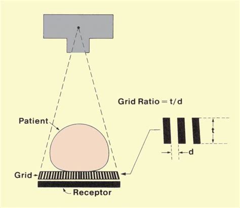 Scattered Radiation And Contrast