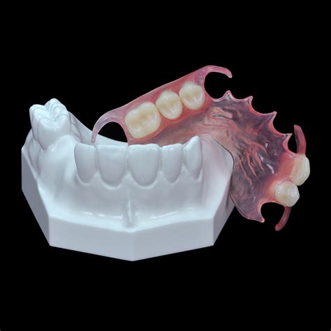 GD-07 Flexible Partial Upper Denture Paradigm Dental Models, 60% OFF