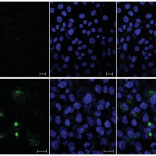 Expression Of Hcv Core Protein In Sf Cells Exposed To Hcv Infected