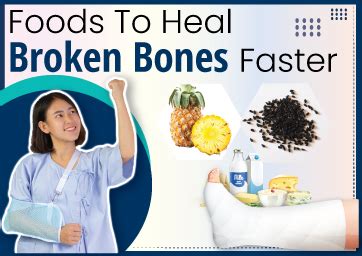 Foods To Heal Broken Bones Faster