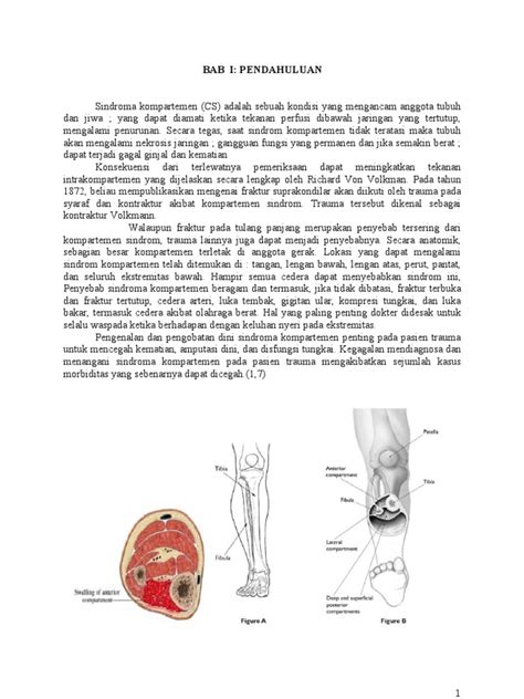 PDF Refrat Compartemen Syndrom DOKUMEN TIPS