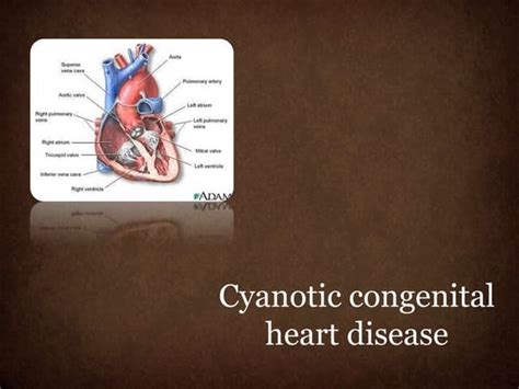 Approach To Congenital Cyanotic Heart Diseases