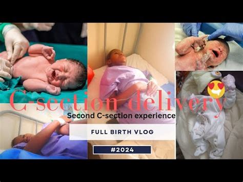 BIRTH VLOG 2024 Planned C Section At 38weeks Positive Birth Experience