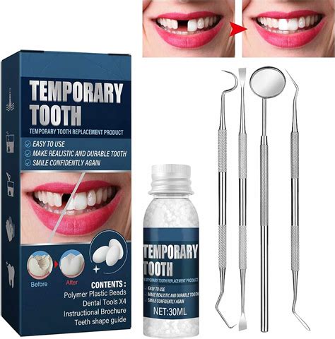 Tooth Repair Kit Moldable Tooth Filling Repair Kit