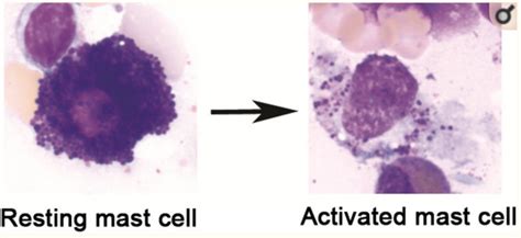 mast cells mcas genetics  solutions