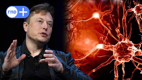 Elon Musk plant mit Neuralink Chips für unser Gehirn