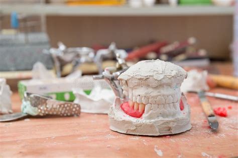 Manufacturing of dentures stock photo. Image of cosmetology - 274493832