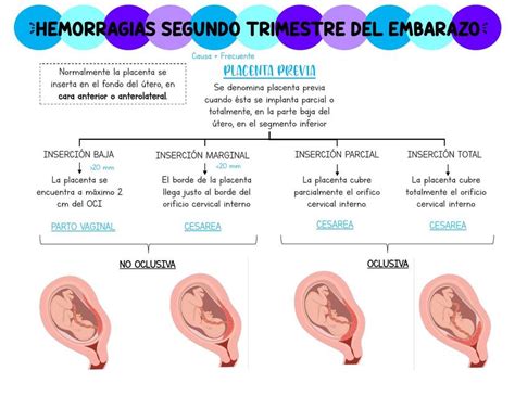 Hemorragias Del Segundo Trimestre Del Embarazo Medy Loving Udocz