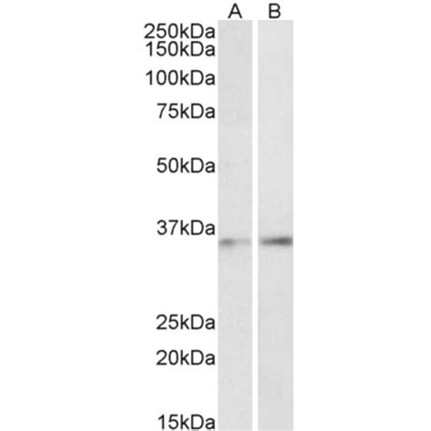 Anti Cebp Beta Antibody A85133