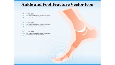 Fracture Powerpoint Templates Slides And Graphics