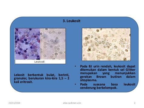 Isi Atlas Sedimen Urin