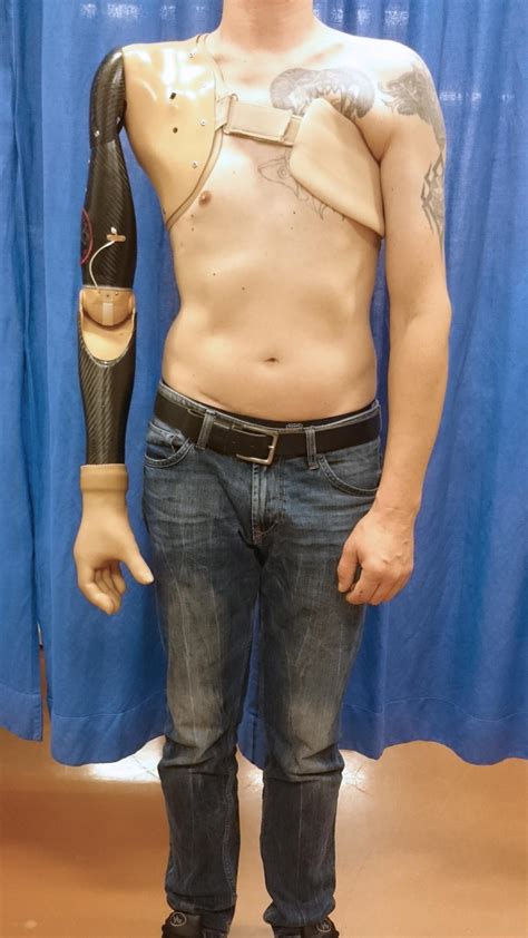 Prosthetic Technology In The S IMAGE EurekAlert Science News Releases