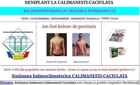 Deniplant Remedii Naturale Pentru Psoriazis Si Alte Afectiuni