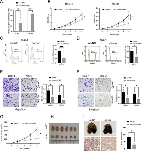 Circ Ip K Suppresses Tumor Progression By Modulating The Mir P