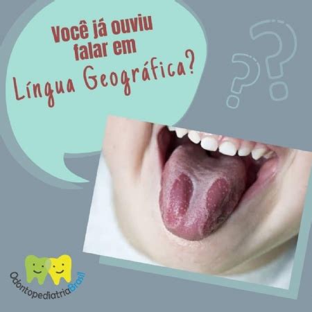 Lingua Geografica O Que Causa - Língua geográfica - Dicas | Dra. Larissa Miyata – Odontologia ...