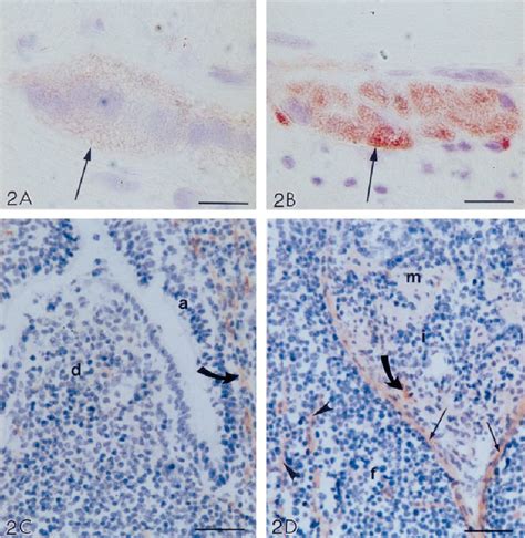 Immunohistochemical Detection Of PrP In The Ileal Peyers Patch Of