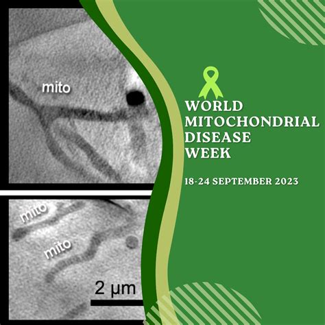 Siriusxt Advocating For Mitochondrial Health During World Mitochondrial