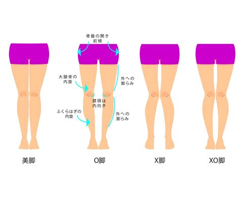 腰痛や猫背はo脚が原因？3つの原因について解説 骨盤矯正・産後骨盤矯正専門ボディケアサロン│骨盤labo