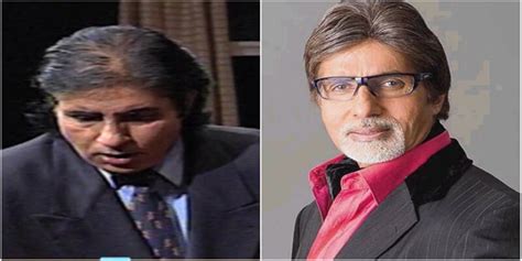 Amitabh Bachchan Hair Transplant - Bollywood Celebrities Who Underwent ...