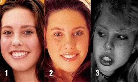 When Plastic Surgery Fails 38 Pics Izismile