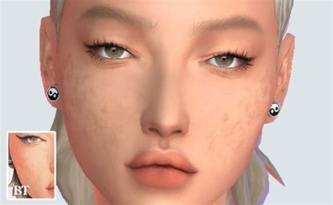 Sims Scars Cc Body Acne And More Scar Mods In Sims Cc