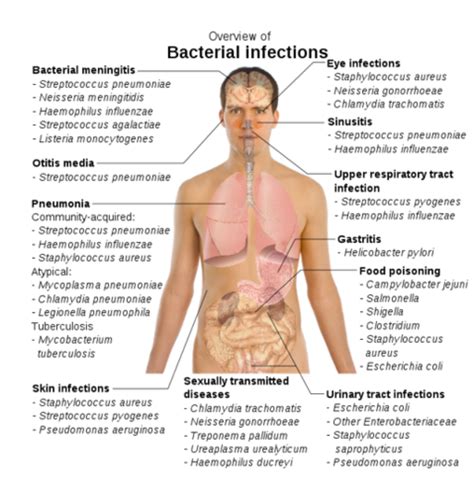 Principles In Infectious Diseases Flashcards Quizlet