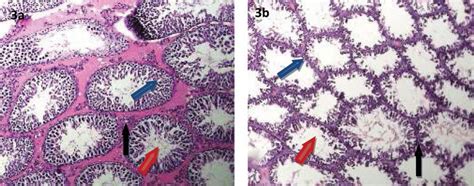 A Photomicrograph Of A Cross Section Of Normal Testicular Tissue