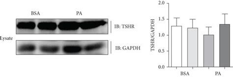 Promotion Of Tshr Palmitoylation By Palmitic Acid Leading To The