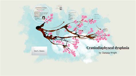 Craniodiaphyseal Dysplasia by Danasia Wright