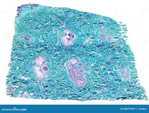 Human skin. Dermis stock image. Image of skin, histological - 288379597