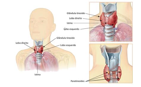 Cirurgia Da Tireoide Como E Indica Es Nicap