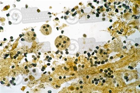 Entamoeba Histolytica Amebiasi 250x Protozoa Protozoi Endoparassiti Parassitologia Foto