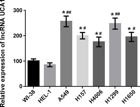 Long Noncoding Rna Lncrna Urothelial Carcinoma Associated Uca