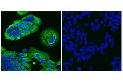 Keratin 14 Ll002 Mouse Mab Cell Signaling Technology