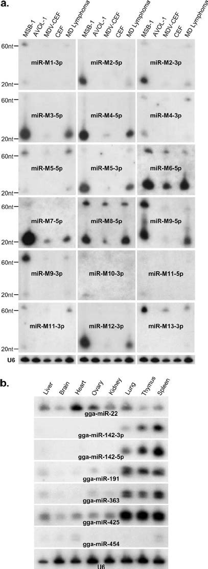 A Northern Blotting Analysis For Determining The Expression Of MDV 1