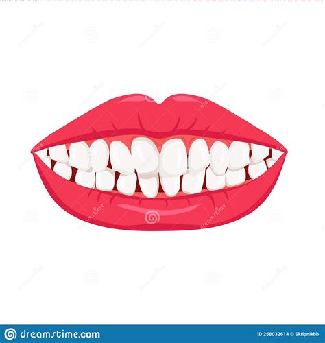 Smile With Crooked Teeth White Misaligned Teeth With Orthodontic