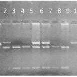 Ethidiumbromide Stained Agarose Gel Showing Detection Of The Single