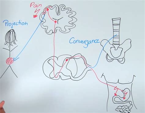 Cervical Spine Visceral Referred Pain Physiotutors