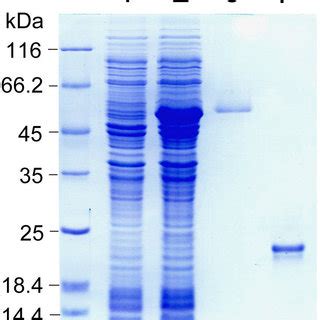 SDS PAGE Gel Showing Expression And Purification Of Recombinant Py01157