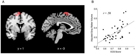 Brain Area For Which Gray Matter Volume Positively Correlated With