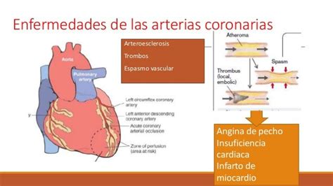 Enfermedades musculo cardiaco parte 1