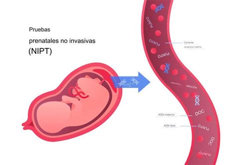 Qué es el test prenatal no invasivo Natalben