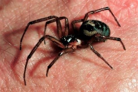 This Is What Happens If A False Widow Spider Bite Becomes Infected And