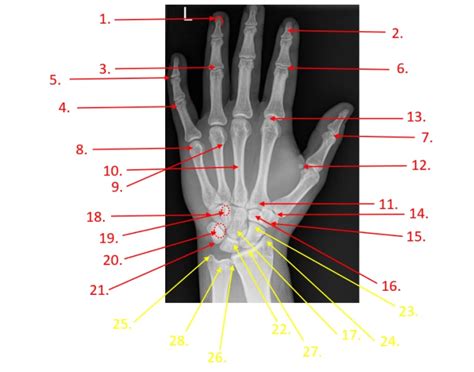 X-Ray of the Left Hand - Anatomy Quiz