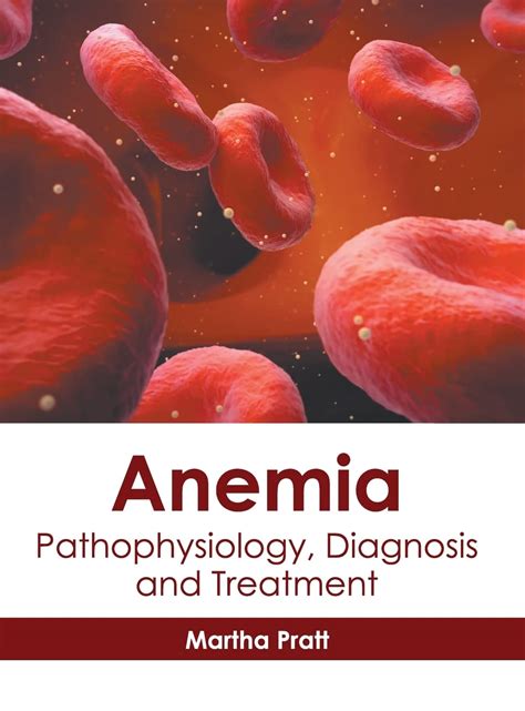 Anemia Pathophysiology Diagnosis And Treatment By Martha Pratt