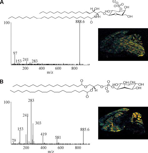 Imaging Of Lipid Species By Maldi Mass Spectrometry Journal Of Lipid Research